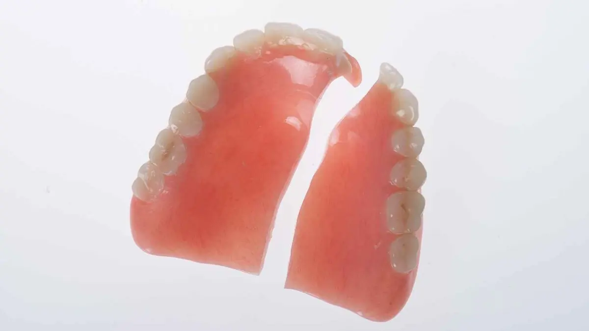 cracked denture Gold Coast - emergency denture repair by prosthetist near you
